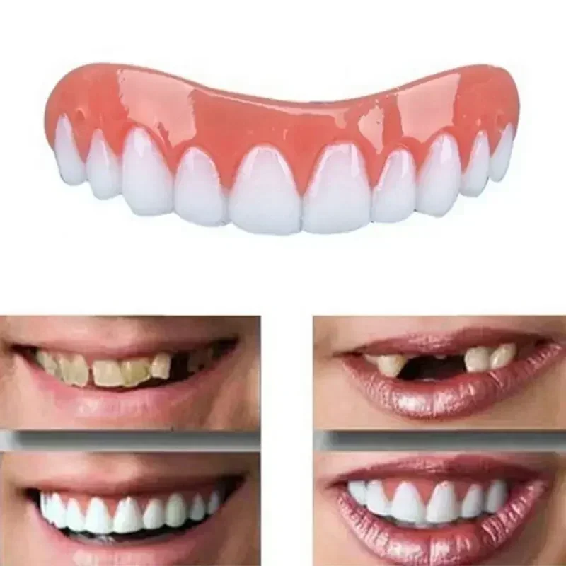 Teeth Whitening Veneers - ฟันปลอมซิลิโคนแบบใหม่ สำหรับฟันบนและฟันล่าง วีเนียร์ยิ้มสวย วีเนียร์ฟันปลอม แปะฟันปลอม ฟันปลอมแบบติดแน่น