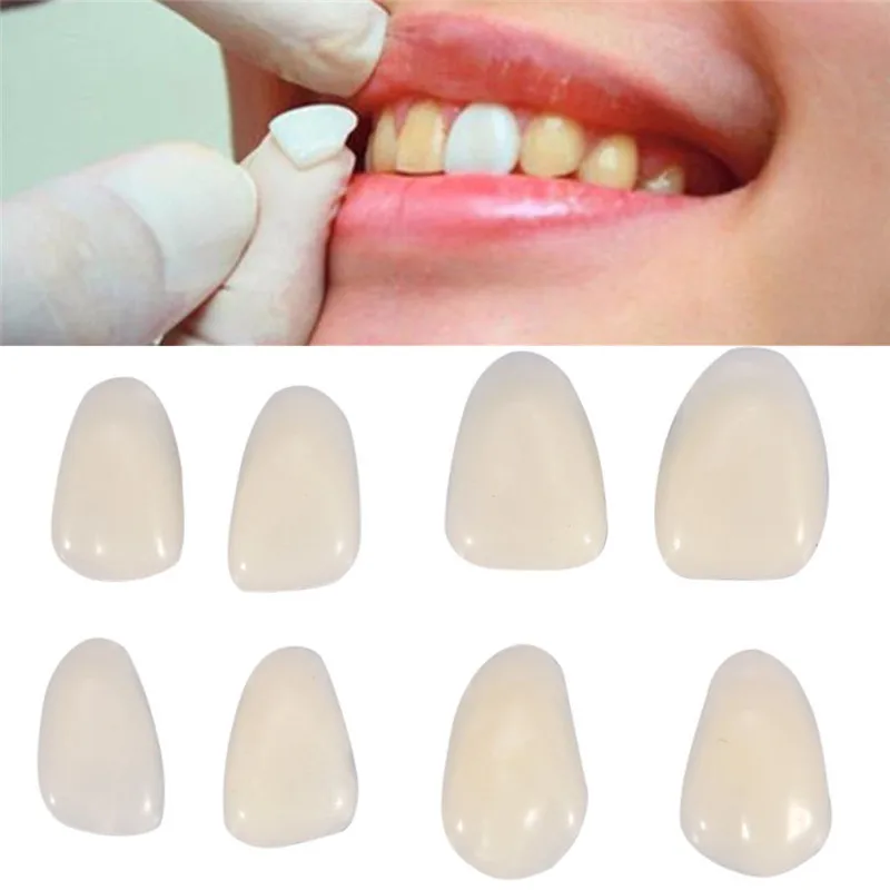 Teeth Paint Whitening - ฟิล์มเคลือบฟันชั่วคราวแบบเรซิ่นสีขาวพิเศษบางเฉียบสำหรับฟันหน้าบน จำนวน 50 ชิ้น/แพ็ค