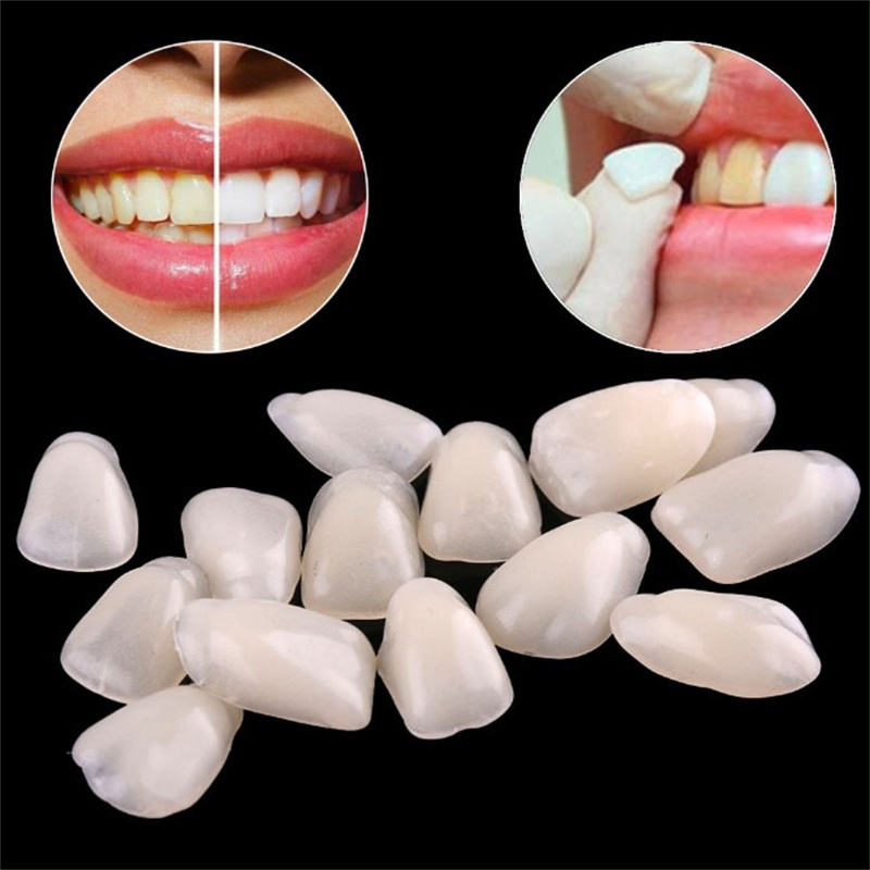 Teeth Whitening Veneers - วีเนียร์ฟันชั่วคราว - แผ่นปิดฟันเรซินบางเฉียบสำหรับฟอกสีฟันและเสริมความสวยงามของฟันหน้า