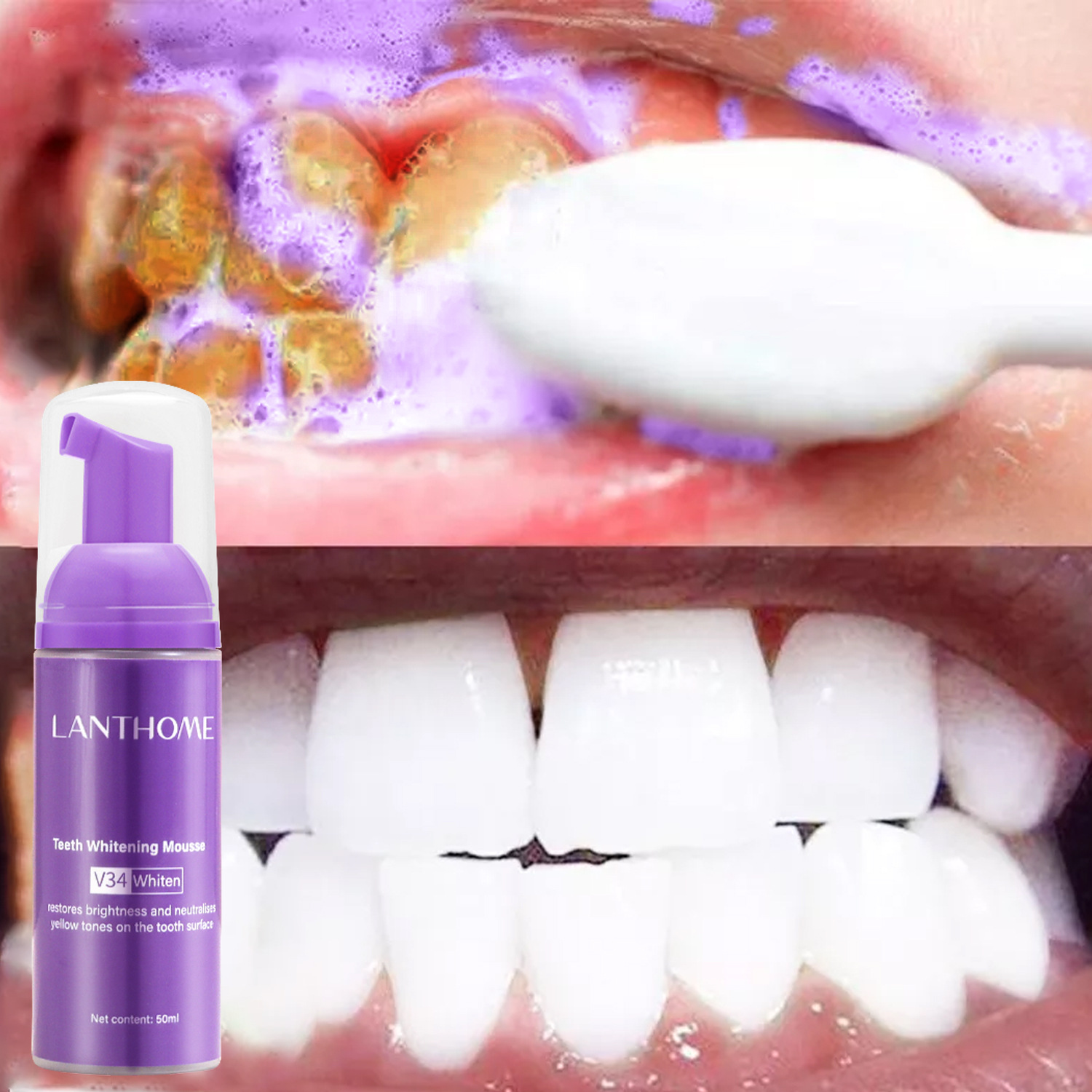 Teeth Whitening (Bleaching) - มูสฟอกฟันขาว V34 ยาสีฟันขจัดคราบพลัค ทำความสะอาดช่องปาก ฟอกฟันขาว อุปกรณ์ดูแลฟัน