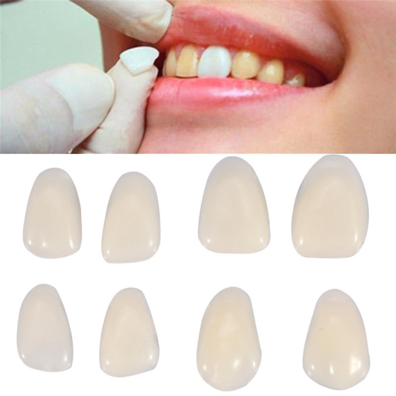 Teeth Whitening Veneers - ทันตกรรมฟันปลอมชั่วคราวฟันมงกุฎ Veneers ฟันด้านบนด้านหน้าไวท์เทนนิ่ง Oral Care ยาสีฟันสูตรเกลือผสมฟลูออไรด์ผสานพลังสมุนไพรฟันขาวสะอาดลดกลิ่นปากเรซิ่น