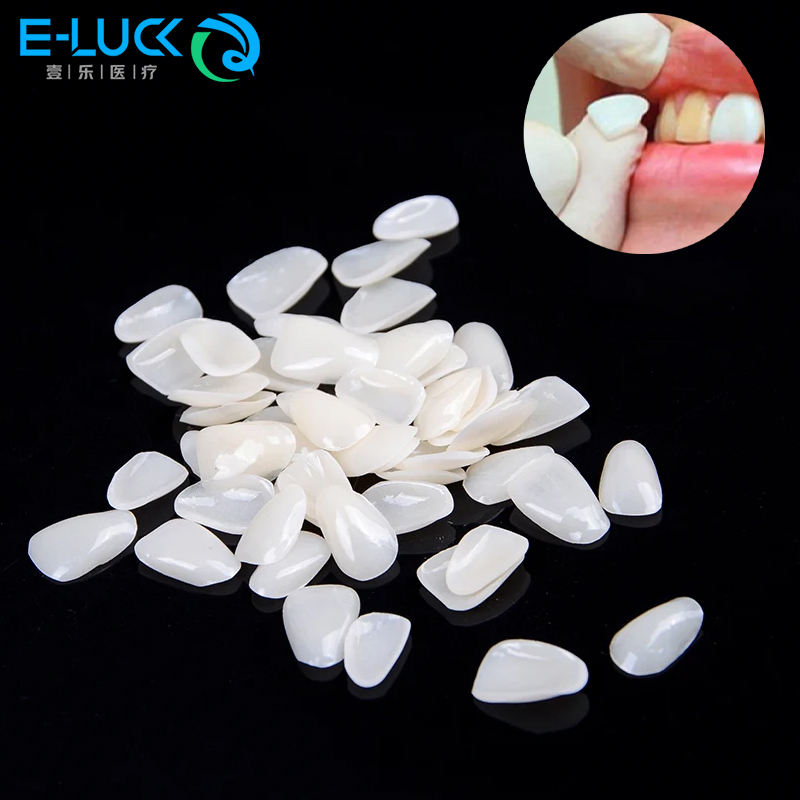 Teeth Whitening Veneers - 50 ชิ้นทันตกรรมฟันวีเนียร์ชั่วคราวมงกุฎเรซินบางเฉียบสําหรับทันตกรรมฟันปกป้องการดูแลช่องปาก