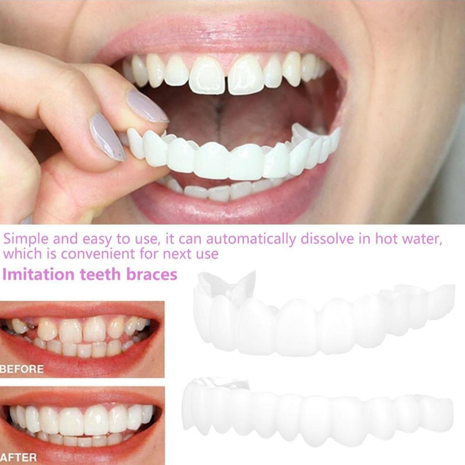 Teeth Whitening Veneers - วีเนียร์ฟันปลอมชั่วคราวสำหรับผู้ชายและผู้หญิง 2 ชิ้น วีเนียร์ฟันบนและล่าง ช่วยปรับปรุงรอยยิ้ม ฟันปลอมแบบใช้ซ้ำได้