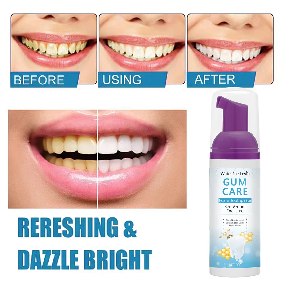 ยาสีฟันโฟมดูแลเหงือกวอเตอร์ไอซ - Teeth Whitening Xylitol Gum บทวิจารณ์และราคา