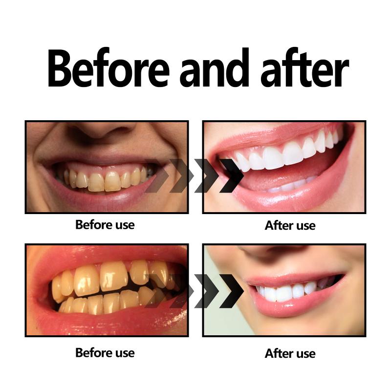 ผงฟอกสีฟัน ผงถ่าน/ผงฟอกสีฟันเบ - Teeth Whitening Charcoal Powder บทวิจารณ์และราคา