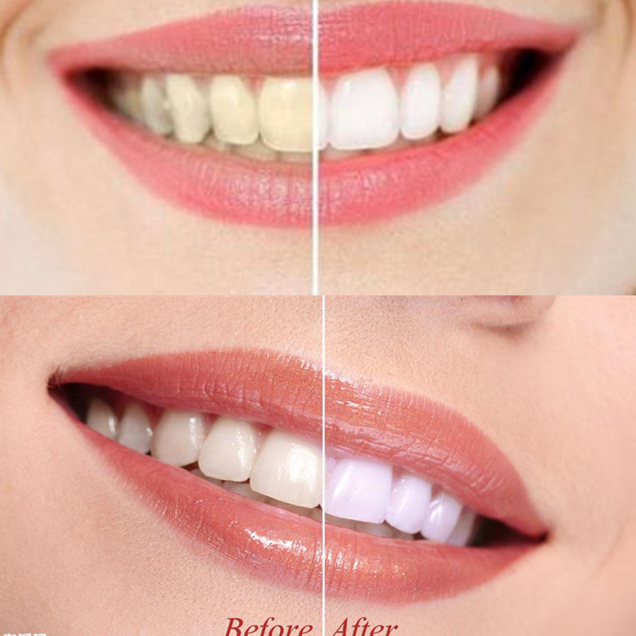 ถ่านไม้ไผ่ฟันฟันทันตกรรมสูตร L - Teeth Paint Whitening บทวิจารณ์และราคา
