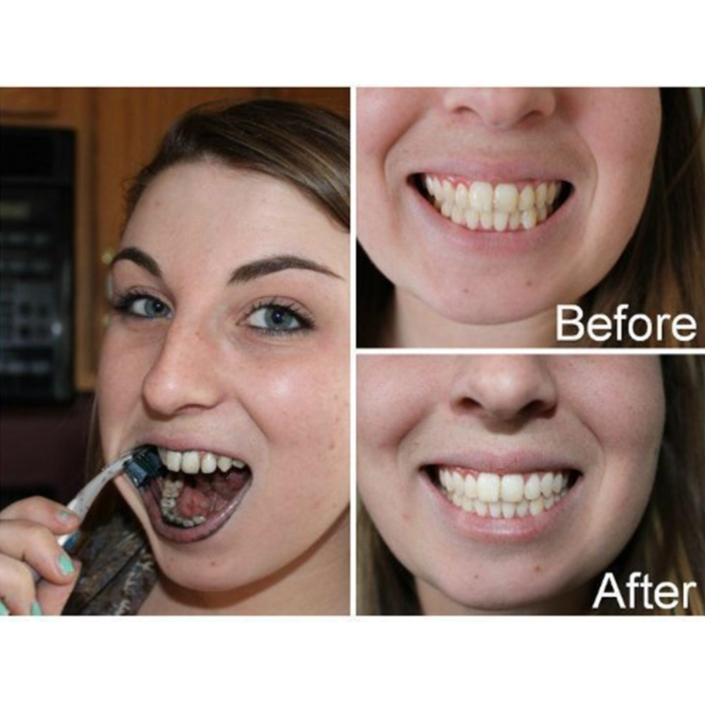 ถ่านไม้ไผ่ฟันฟันทันตกรรมสูตร L - Teeth Paint Whitening บทวิจารณ์และราคา