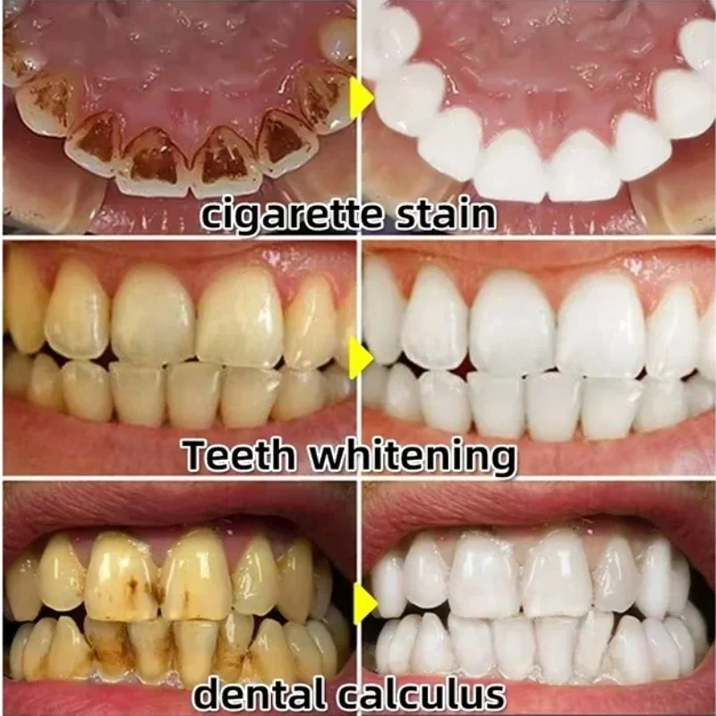 ได้อย่างรวดเร็ว Repair Gum Ser - Teeth Whitening Baking Soda บทวิจารณ์และราคา