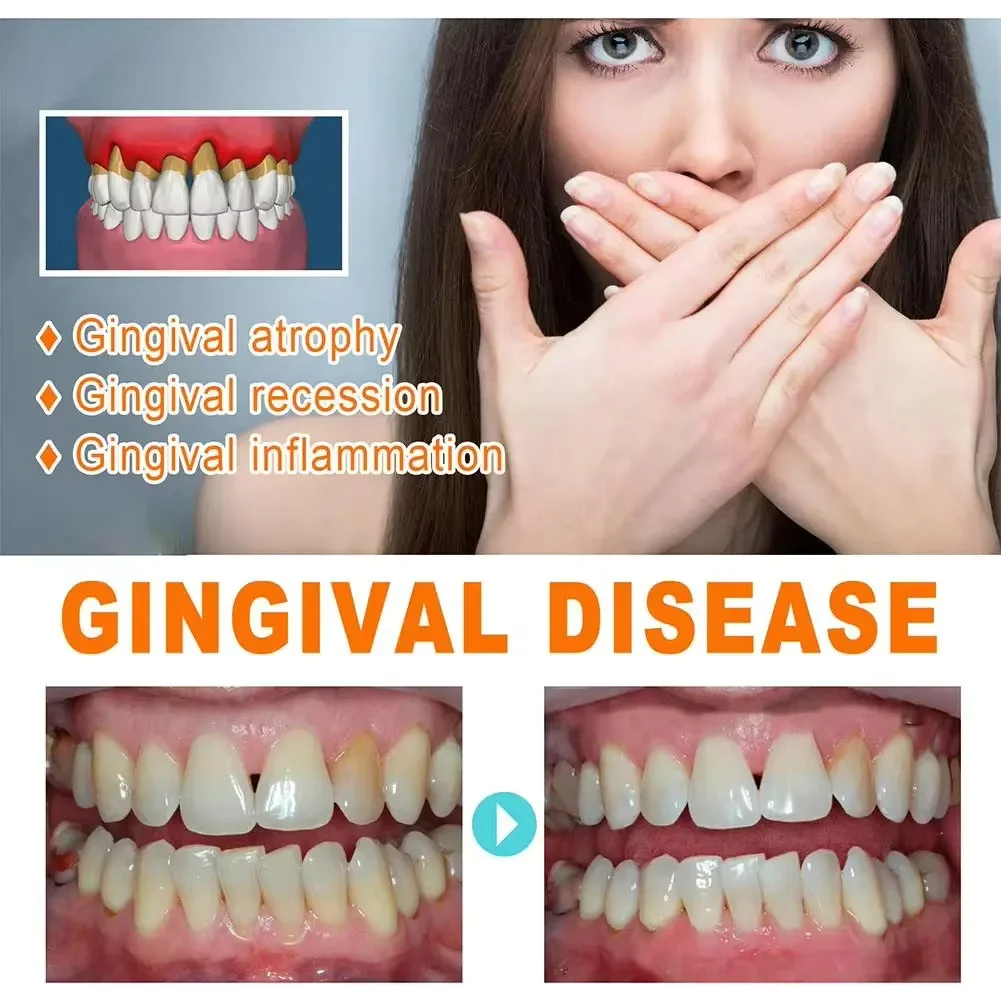 ได้อย่างรวดเร็ว Repair Gum Ser - Teeth Whitening Baking Soda บทวิจารณ์และราคา