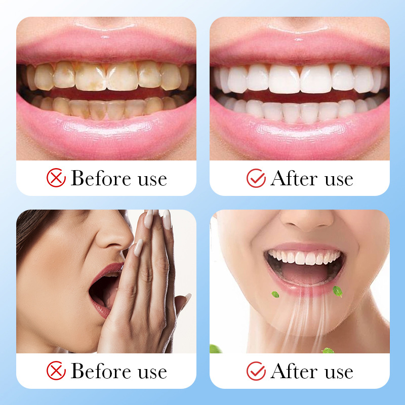 ถ่านไม้ไผ่ ถ่านกัมมันต์ ผงฟอกส - Teeth Whitening Charcoal Powder บทวิจารณ์และราคา