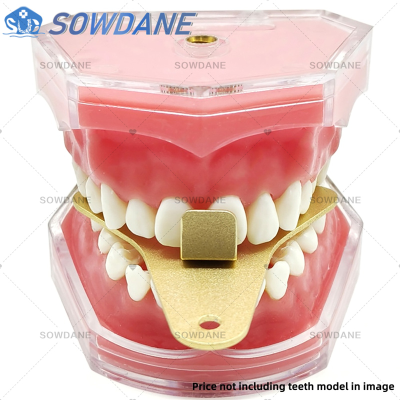 ถาดพิมพ์ฟันสำหรับห้องปฏิบัติกา - Teeth Whitening Trays บทวิจารณ์และราคา