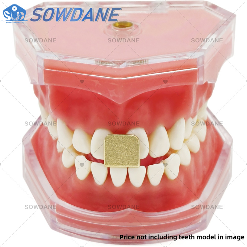 ถาดพิมพ์ฟันสำหรับห้องปฏิบัติกา - Teeth Whitening Trays บทวิจารณ์และราคา