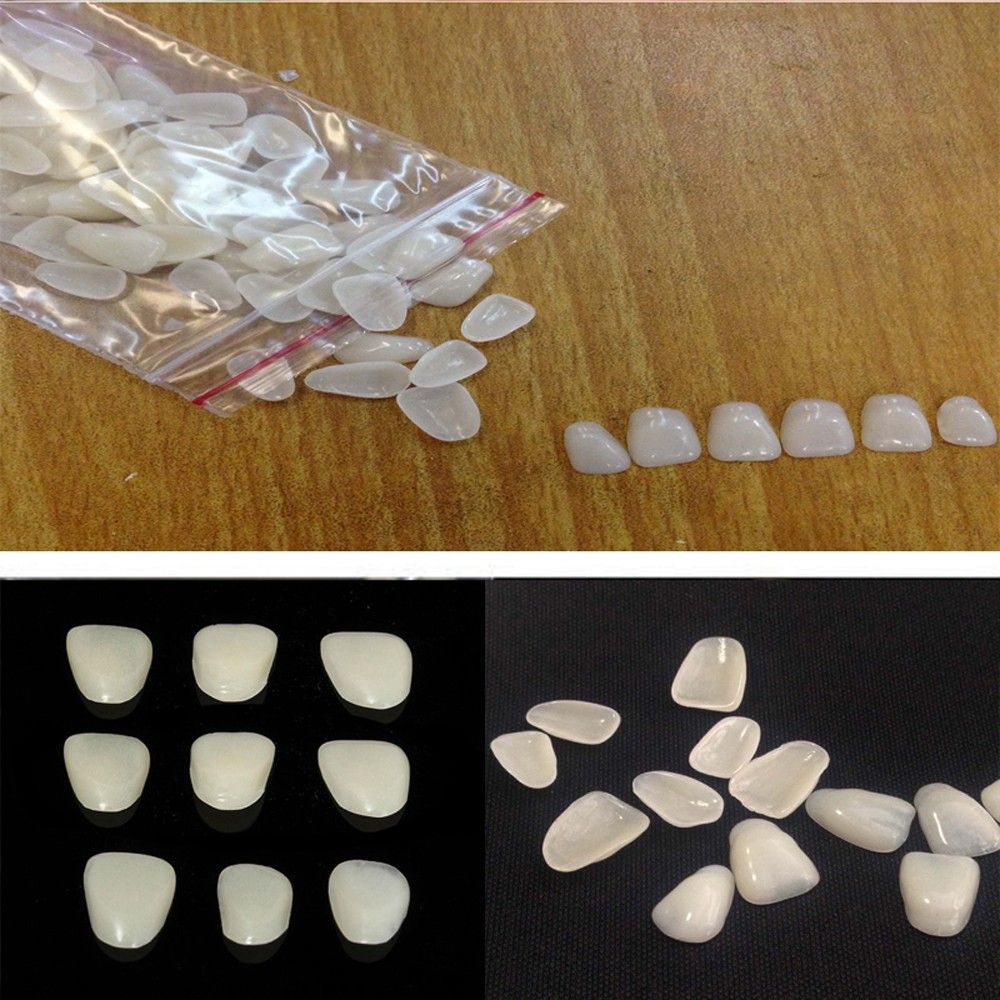 ฟันเรซินวีเนียร์ฟันขาวพิเศษบาง - Teeth Whitening Veneers บทวิจารณ์และราคา