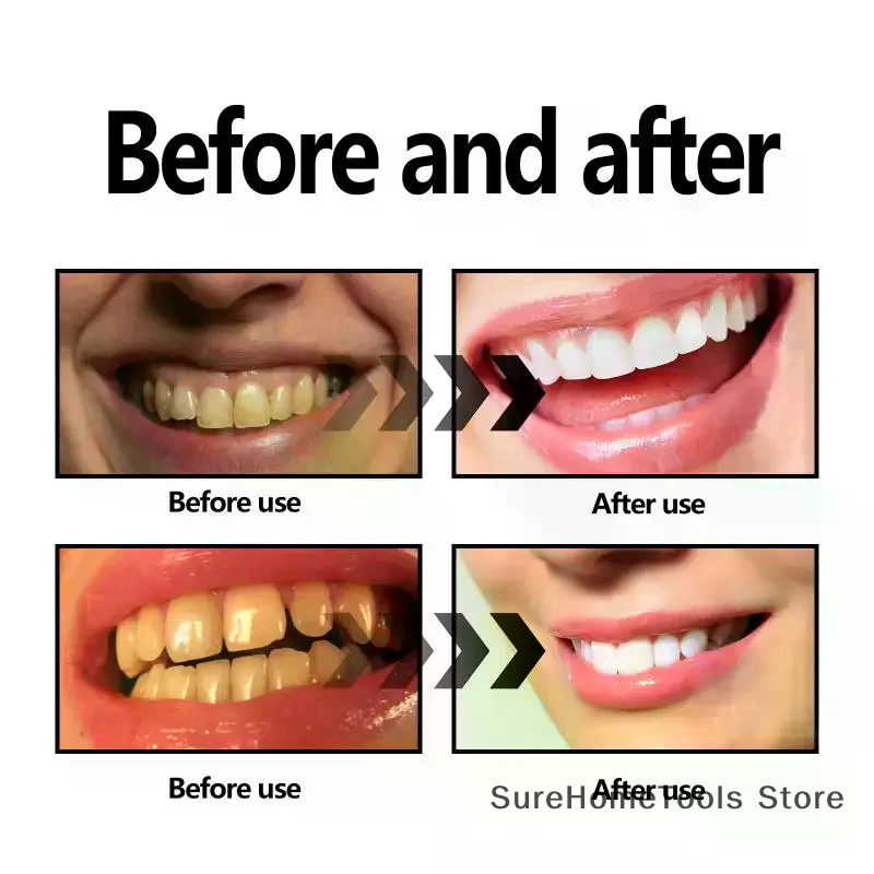 ผงถ่านไม้ไผ่สำหรับฟัน ผลิตภัณฑ - Teeth Whitening Charcoal Powder บทวิจารณ์และราคา