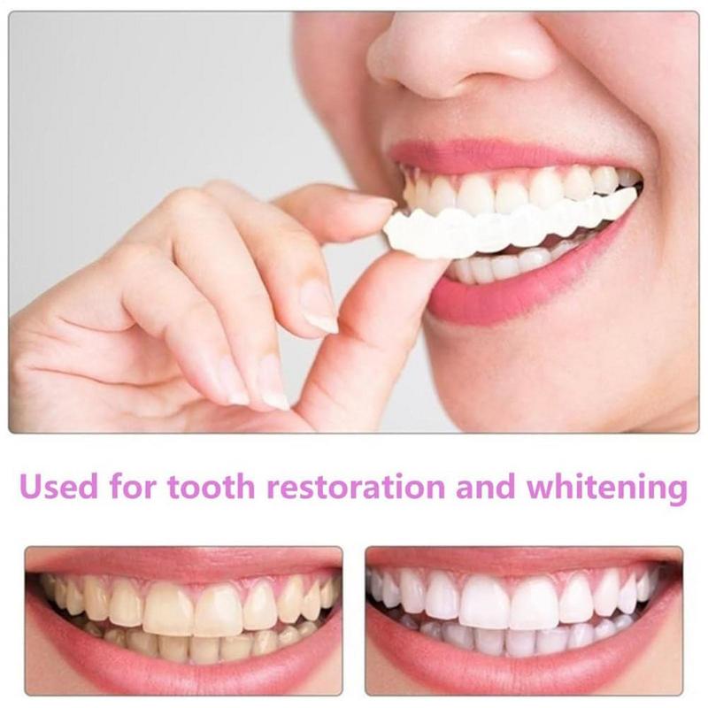 แผ่นปิดฟันแบบสแนปออน วีเนียร์ซ - Teeth Whitening Veneers บทวิจารณ์และราคา