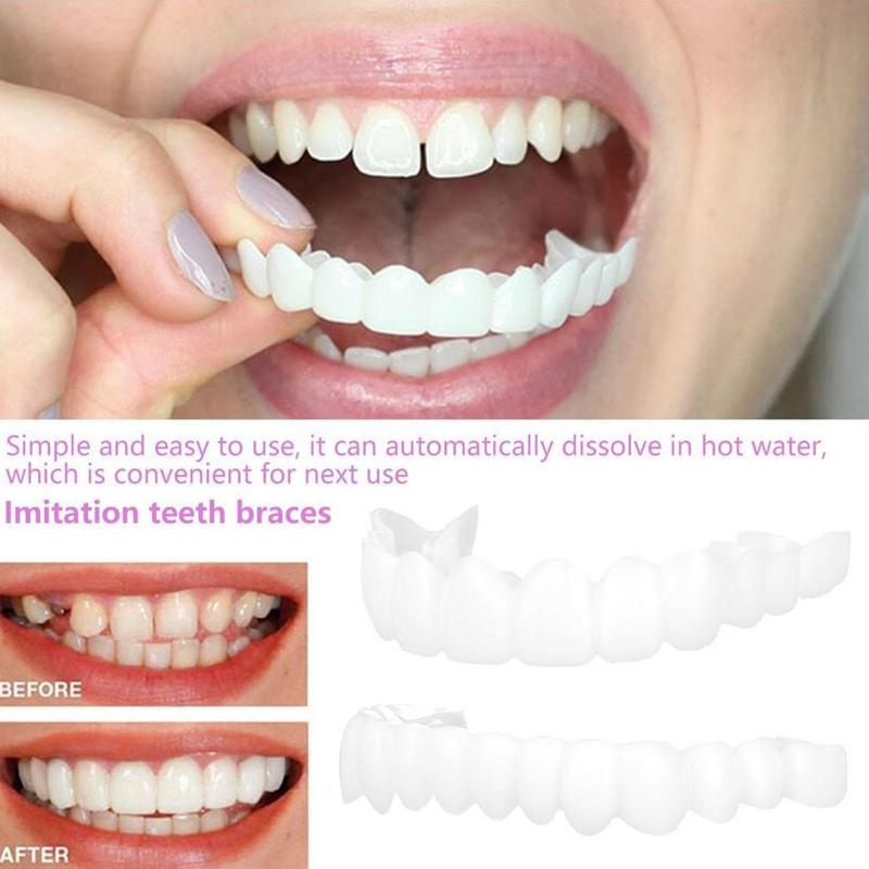 แผ่นปิดฟันแบบสแนปออน วีเนียร์ซ - Teeth Whitening Veneers บทวิจารณ์และราคา