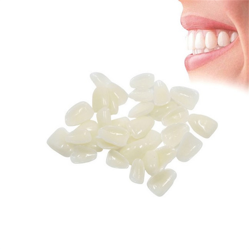 วีเนียร์ฟันชั่วคราว - แผ่นปิดฟ - Teeth Whitening Veneers บทวิจารณ์และราคา