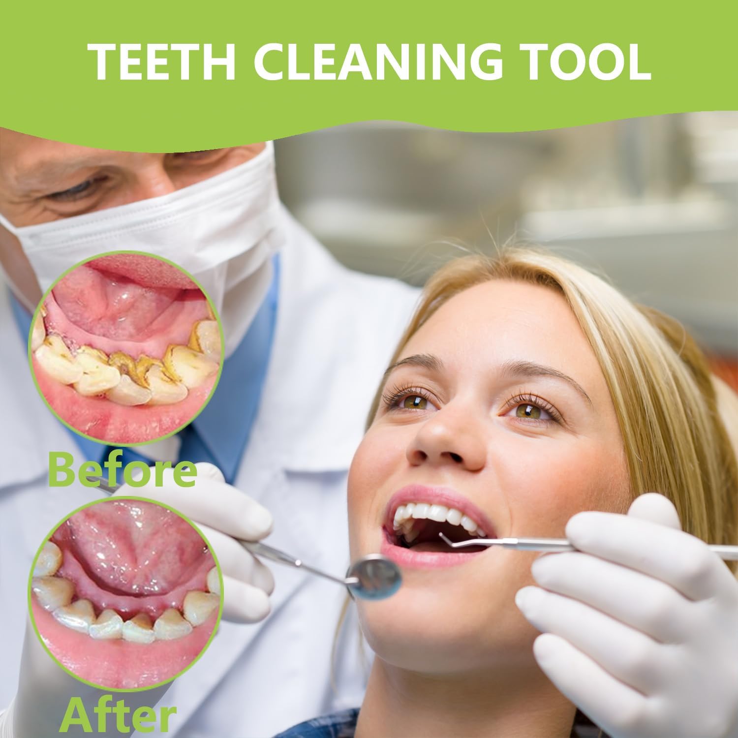 ชุดทำความสะอาดฟันระดับมืออาชีพ - Teeth Whitening Machine Professional บทวิจารณ์และราคา