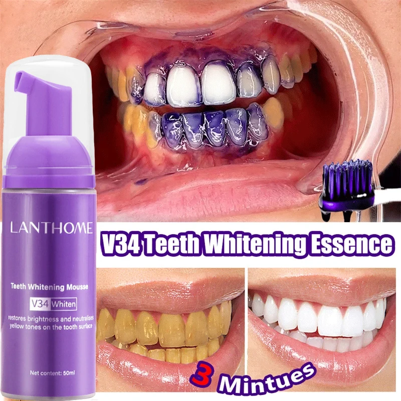 มูสฟอกฟันขาว V34 ยาสีฟันขจัดคร - Teeth Whitening (Bleaching) บทวิจารณ์และราคา