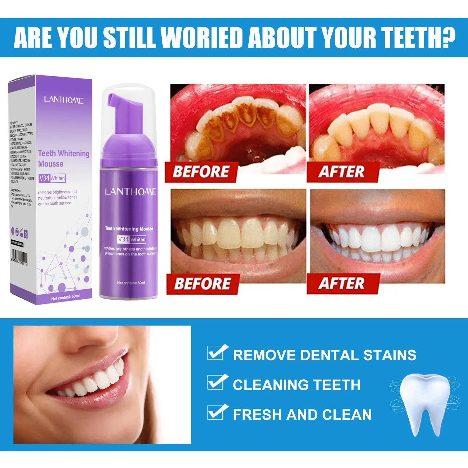 มูสฟอกฟันขาว V34 ยาสีฟันขจัดคร - Teeth Whitening (Bleaching) บทวิจารณ์และราคา