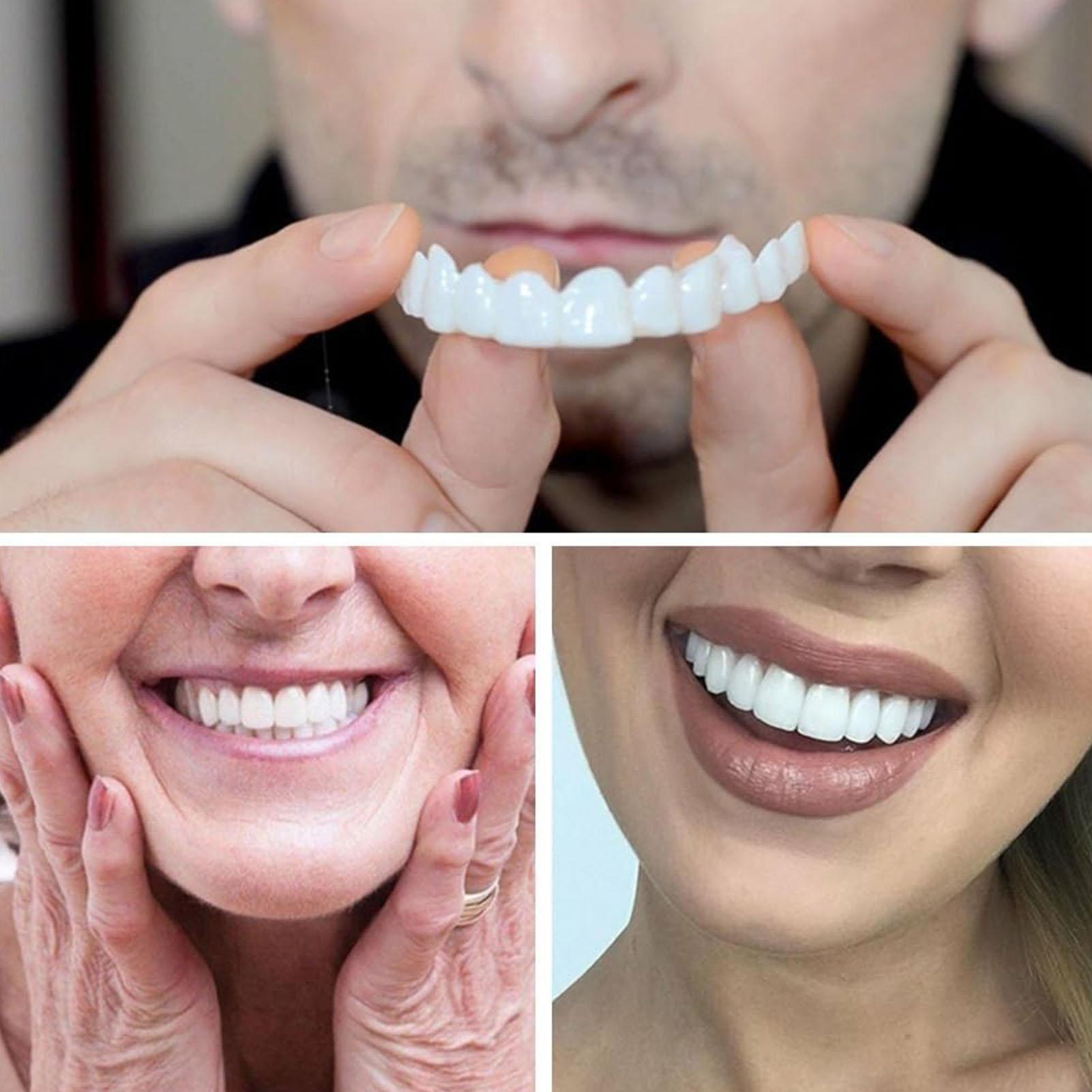 วีเนียร์ฟันปลอมชั่วคราวสำหรับผ - Teeth Whitening Veneers บทวิจารณ์และราคา
